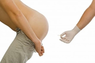 Tips mengobati wasir setelah melahirkan, obat buat penyakit ambeien untuk wanita menyusui, obat penyakit ambeien setelah operasi, jual obat ambeien di pasangkayu, cara menghilangkan wasir ringan, cara alami mengobati penyakit wasir luar, wasir ambeien berdarah, mengobati wasir setelah melahirkan, obat penurun bengkak ambeien, cara mengobati ambeyen dengan air hangat, obat buat penyakit ambeien di paringin